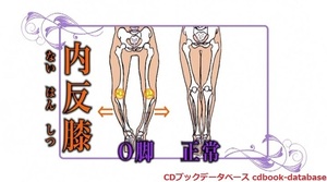 O脚革命3.jpg